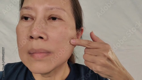 portrait the fingers holding the flabbiness adipose sagging skin, swelling and ptosis, smile lines and loose, wrinkle and scar, blemish and freckles on the face, health care and beauty concept.