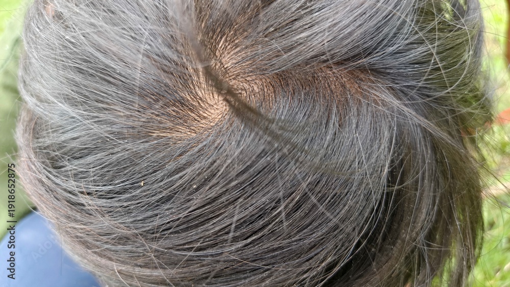 Fototapeta premium Close-up top view of human hair whorl showing natural scalp and black hair texture. Perfect for hair care topics, dermatology, alopecia awareness, genetics, and medical or cosmetic education