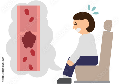長時間同じ姿勢で足が痛む男性と静脈の弁に詰まった血栓のエコノミー症候群のイラスト素材
