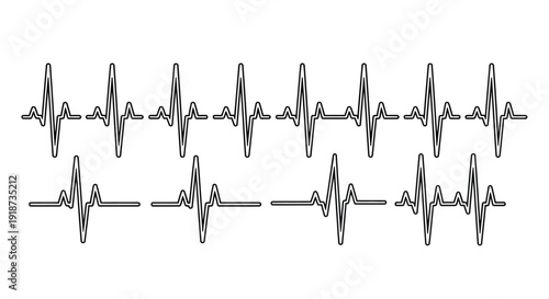 Two electrocardiogram lines displaying a heart rhythm pattern on white