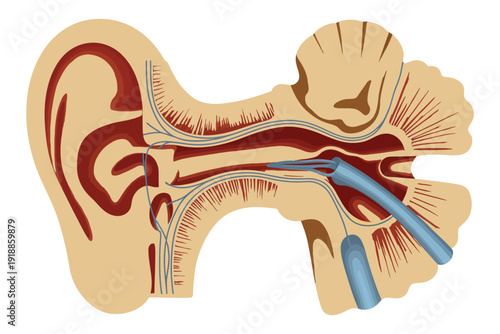 Diagram illustrating the anatomy of the human ear and its internal structures.