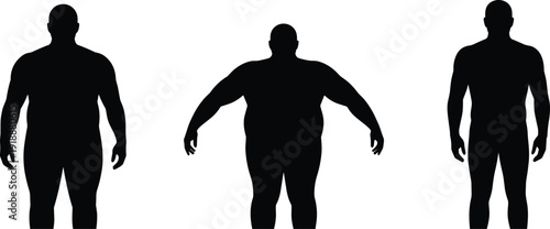 Male body silhouette comparison vector set showing normal and obese figures, front view human shapes isolated on white background