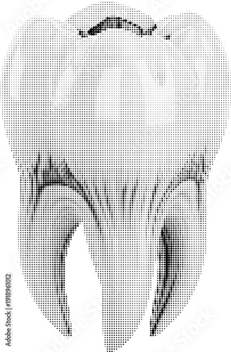 A detailed illustration of a molar tooth in a cross-hatch style on a white background