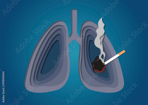 Smoking and lung health, conceptual illustration