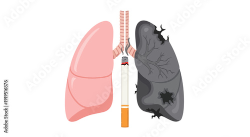 Anatomical illustration of a healthy pink lung and a diseased black lung with a cigarette.