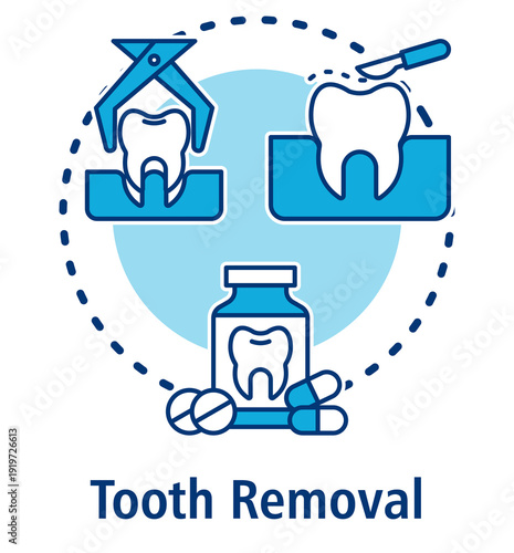 Tooth Removal blue concept icon with Tooth Extraction, Dental Surgery, Painkiller.