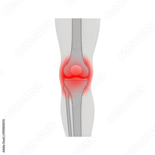 Knee Joint Pain 3D Icon