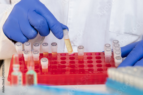 A scientist shows a laboratory stand with small test tubes from which he took out one test tube with a yellow liquid, the development of medicinal drugs.