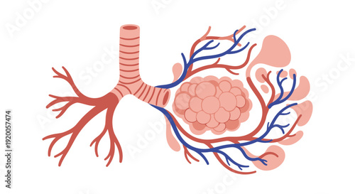 Detailed anatomical illustration of human lungs with tumor.