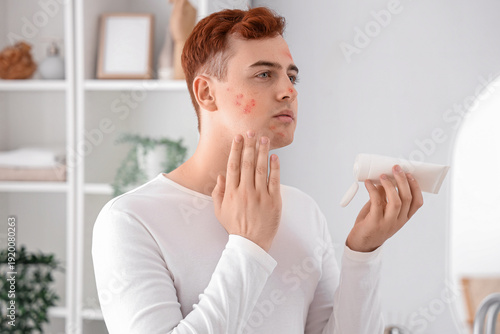 Teenage boy applying remedy...