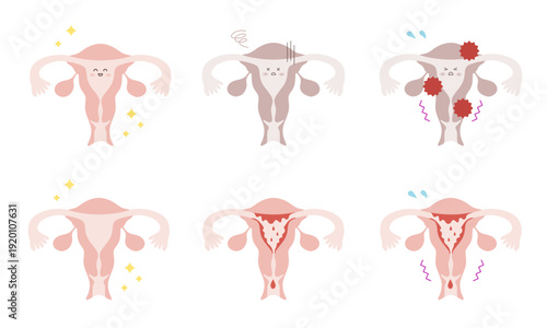 さまざまな状態の子宮イラストセット/ Uterus Illustration Set in Various Conditions