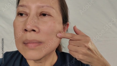 portrait the fingers holding the flabbiness and lines beside the mouth, Flabbiness and Flabby skin, blemish and freckles on the face, health care and beauty concept 