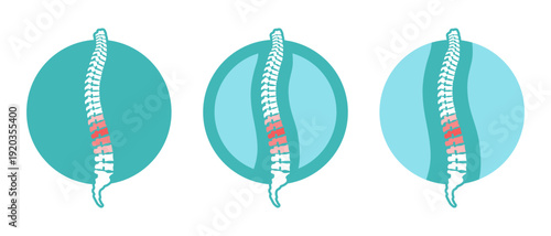 Spine human with pain graphic icons set. Backache signs in the circle isolated on green background. Vector illustration 