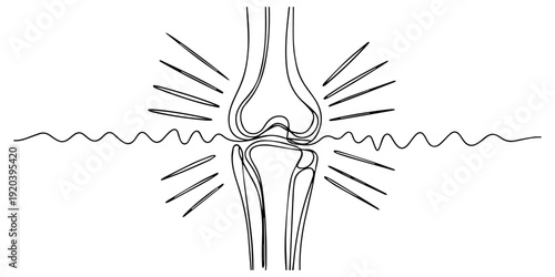 Knee Joint with Radiating Pain continuous one line drawing, Simple black line drawing of a human knee joint with pain, Hand drawn sketch of a human knee joint with radiating lines suggesting pain pro.