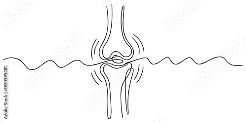 Knee Joint with Radiating Pain continuous one line drawing, Simple black line drawing of a human knee joint with pain, Hand drawn sketch of a human knee joint with radiating lines suggesting pain pro.