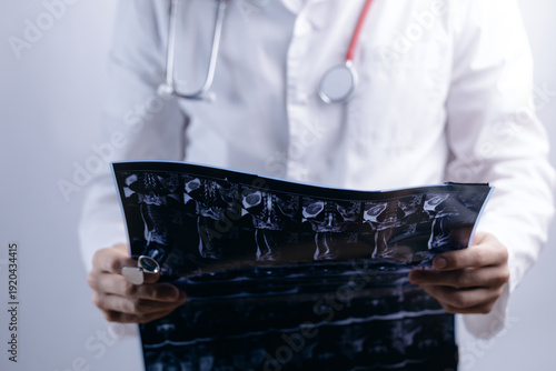 Obraz na plátne Male doctor hold MRI scan of spinal column showing disc protrusion, white clinic background