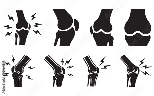 Human Knee Illustration Set – Healthy and Injured Joint Anatomy Comparison VectorWeb