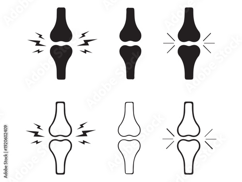 Human Knee Illustration Set – Healthy and Injured Joint Anatomy Comparison VectorWeb