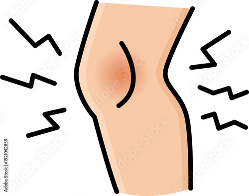 Inflamed knee illustration