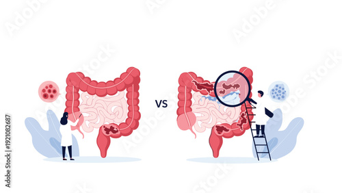 Medical comparison of a healthy human colon versus one affected by disease with doctors using a magnifying glass for clinical diagnosis.