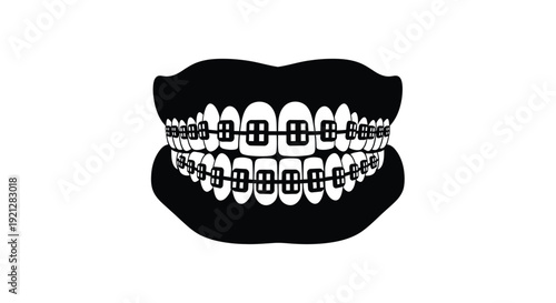 A black silhouette of a mouth with braces dental health illustration silhouette