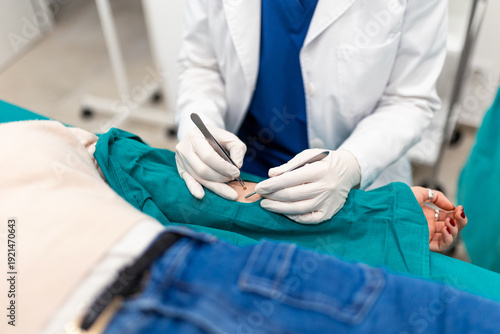 Close-up of doctor removing mole from patient arm with surgical tweezers and scalpel. Dermatology procedure, biopsy and minor surgery concept. Professional physician performing skin treatment.