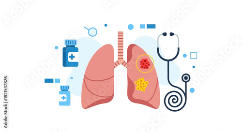 Lung Disease Diagnosis and Treatment Medical Illustration