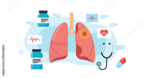 Lung Cancer Diagnosis and Treatment Medical Illustration
