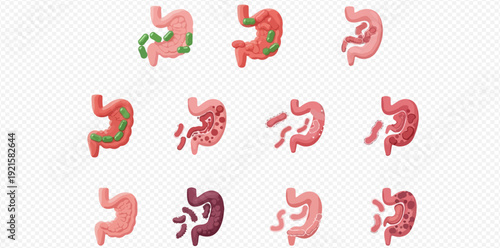 Stomach disease icon set illustrating various gastrointestinal conditions like pain, ulcers, and inflammation.