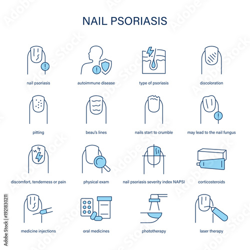 Nail Psoriasis symptoms, diagnostic and treatment vector icon set