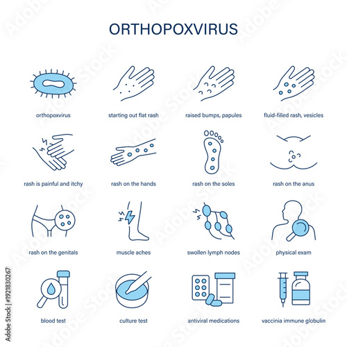 Orthopoxviruses symptoms, diagnostic and treatment vector icon set