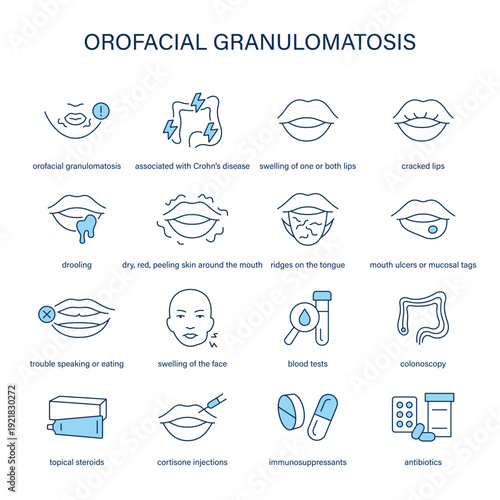 Orofacial Granulomatosis symptoms, diagnostic and treatment vector icon set