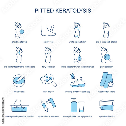 Pitted Keratolysis symptoms, diagnostic and treatment vector icon set