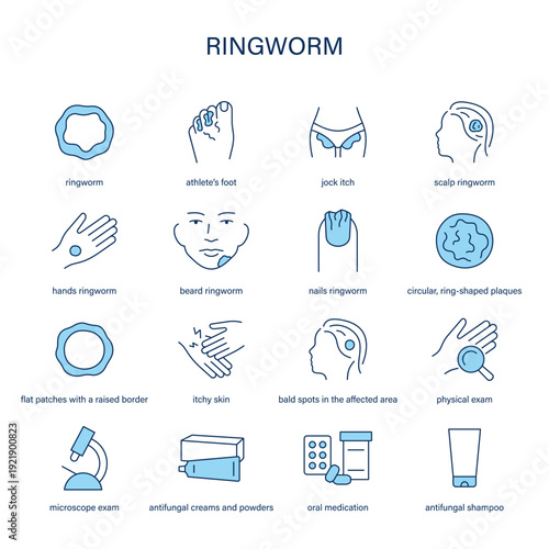 Ringworm symptoms, diagnostic and treatment vector icon set