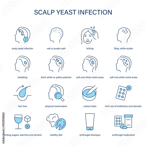 Scalp Yeast Infection symptoms, diagnostic and treatment vector icon set