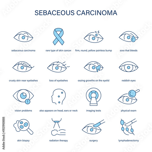 Sebaceous Carcinoma symptoms, diagnostic and treatment vector icon set