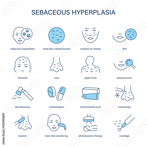 Sebaceous Hyperplasia symptoms, diagnostic and treatment vector icon set