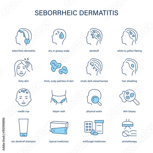Seborrheic Dermatitis symptoms, diagnostic and treatment vector icon set