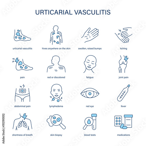 Urticarial Vasculitis symptoms, diagnostic and treatment vector icon set
