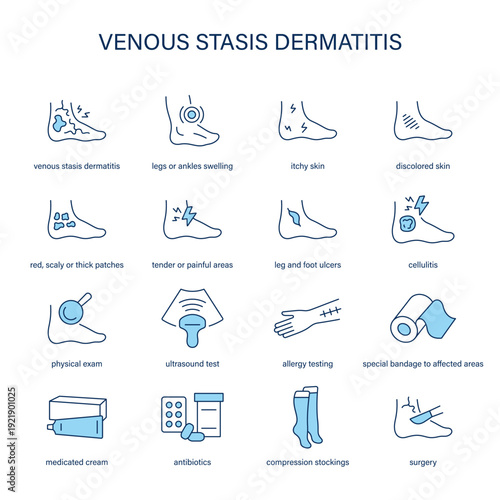 Venous Stasis Dermatitis symptoms, diagnostic and treatment vector icon set