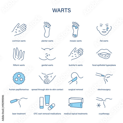 Warts symptoms, diagnostic and treatment vector icon set