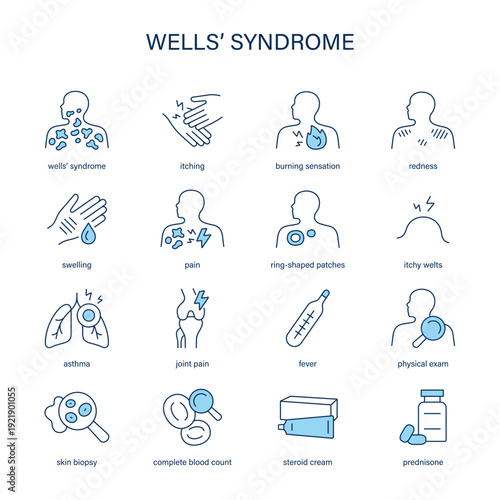Wells’ Syndrome symptoms, diagnostic and treatment vector icon set