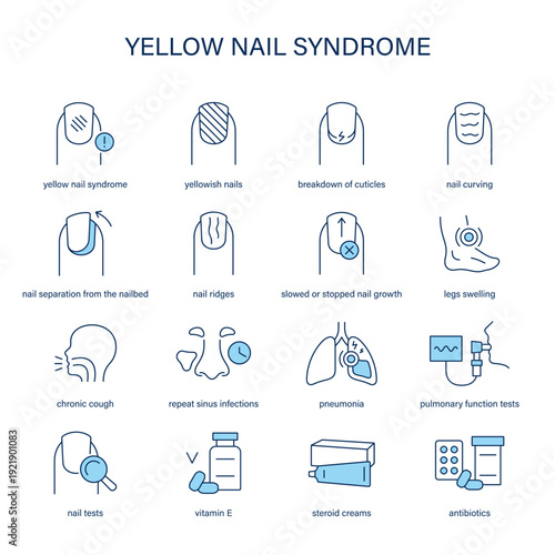 Yellow Nail Syndrome symptoms, diagnostic and treatment vector icon set