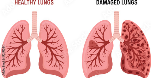 Healthy and Damaged Human Lungs Comparison