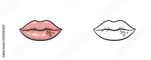 Human lips with cold sore herpes virus in colored and line art styles showing skin infection on white background representing dermatology and medical condition