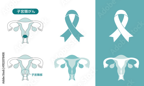 子宮頸がん啓発リボンと子宮のイラスト