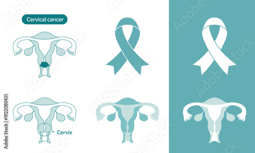 Cervical Cancer Awareness Ribbon and Uterus Illustration