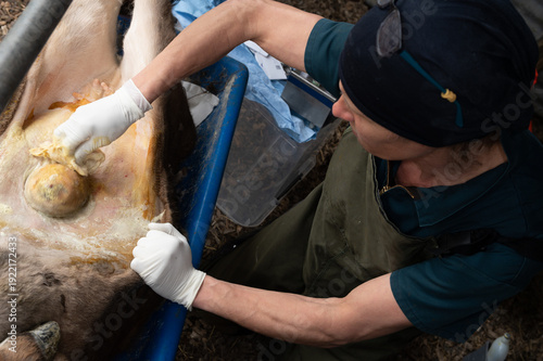 Field surgery - umbilical hernia