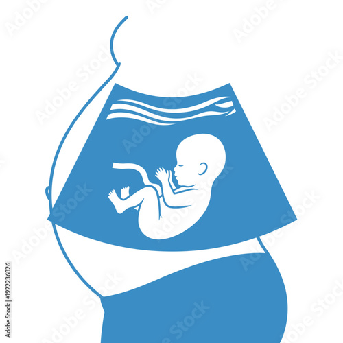Illustration of a pregnant woman with an ultrasound scan image