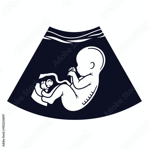 Fetal ultrasound image depicting a developing baby inside the womb